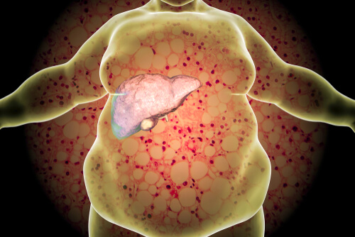 10 important things you need to know about Fatty Liver