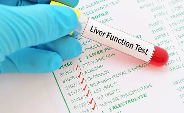ALT, AST and GGT: Understanding Your Liver Blood Tests