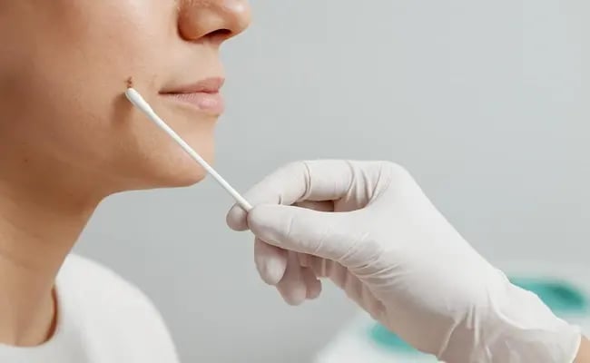 Can Cryotherapy Treat Sun Spots and Age Spots? Results Explained