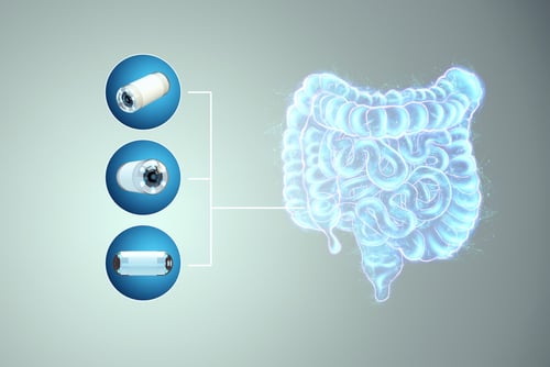 Capsule Endoscopy