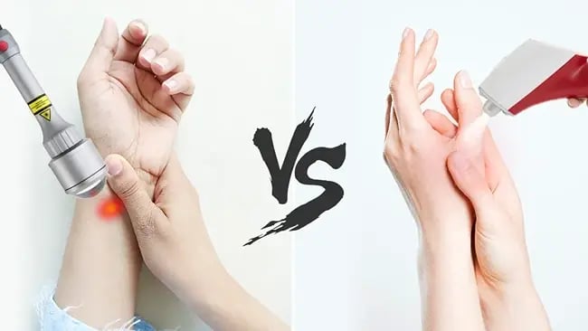 Cryotherapy vs Laser for Skin Lesions: Which Treatment Is Better?
