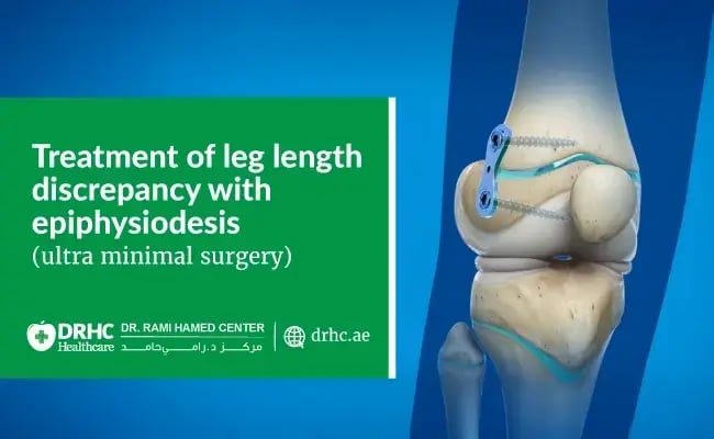 Treatment of Leg Length Discrepancy with Epiphysiodesis (Ultra Minimal Surgery)