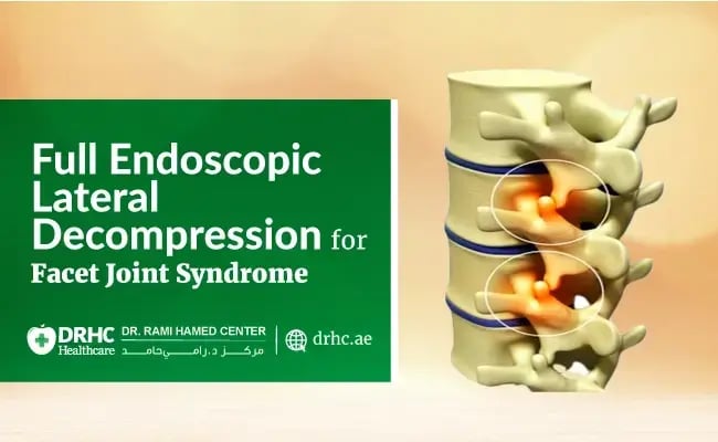 Full Endoscopic Lateral Decompression for Facet Joint Syndrome
