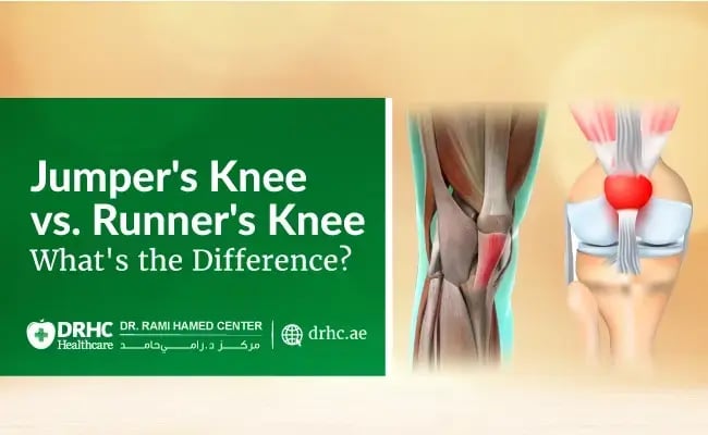 Jumper's Knee vs. Runner's Knee