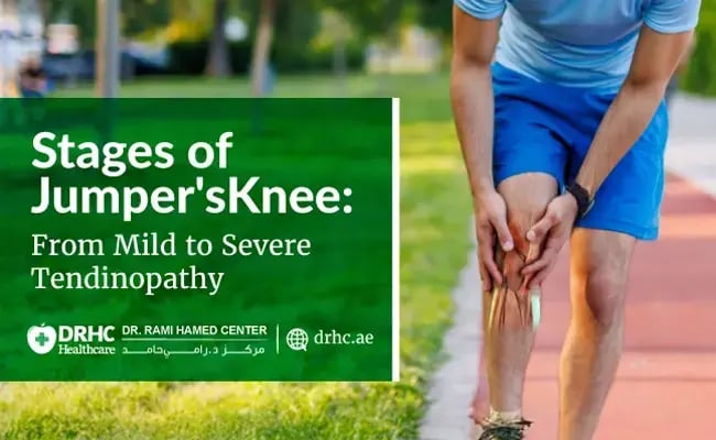Stages of Jumper's Knee: From Mild to Severe Tendinopathy