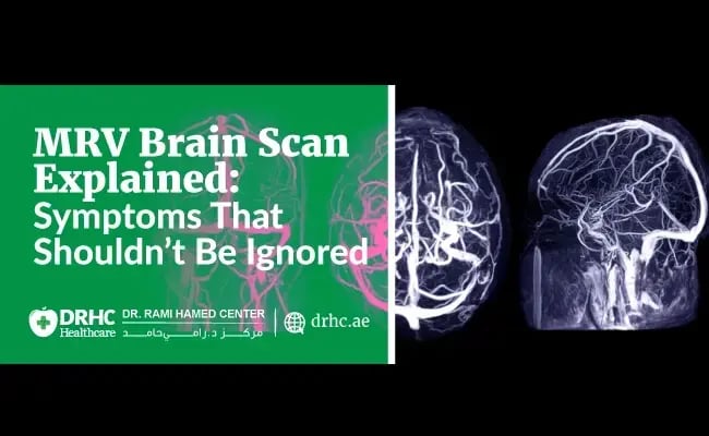 MRV Brain Scan Explained: Symptoms That Shouldn’t Be Ignored