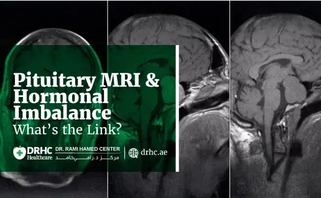 Pituitary MRI and Hormonal Imbalance – What’s the Link?