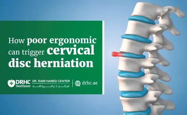 How poor ergonomics can trigger cervical disc herniation