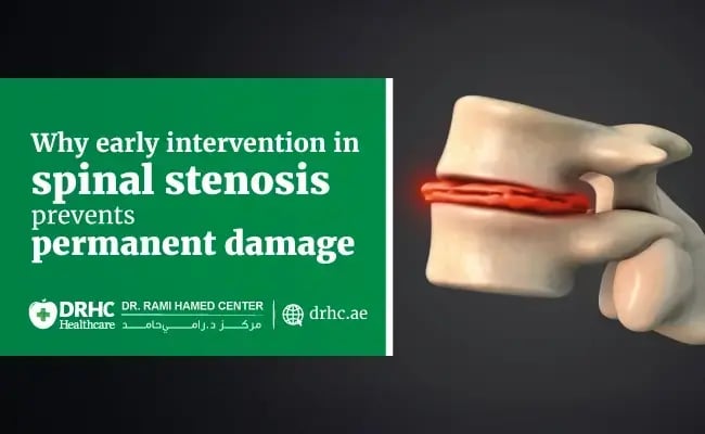 Why early intervention in spinal stenosis prevents permanent damage
