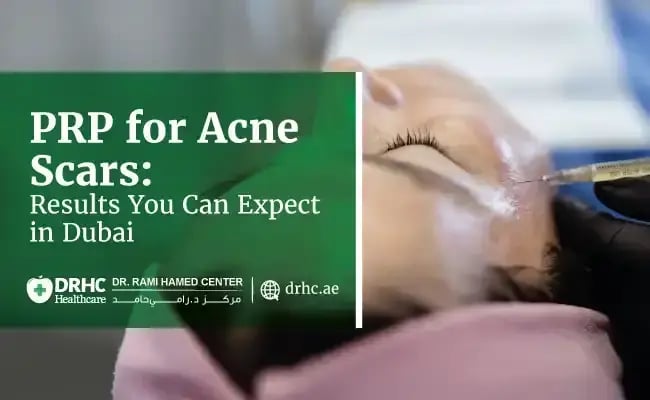 PRP for Acne Scars: Results You Can Expect in Dubai