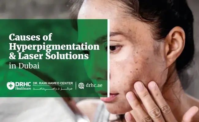 Causes of Hyperpigmentation and Laser Solutions in Dubai