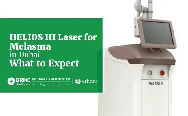 HELIOS III Laser for Melasma in Dubai: What to Expect