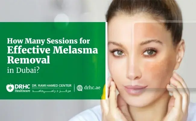 How Many Sessions for Effective Melasma Removal in Dubai?