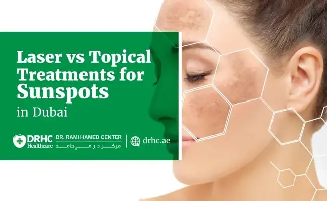 Laser vs Topical Treatments for Sunspots in Dubai