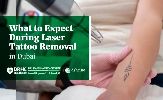 What to Expect During Laser Tattoo Removal in Dubai