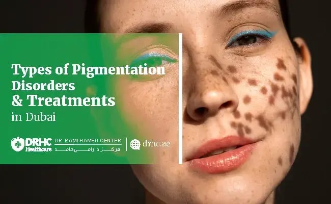 Types of Pigmentation Disorders & Treatments in Dubai