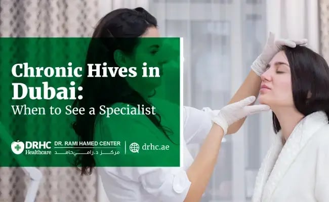 Chronic Hives in Dubai: When to See a Specialist