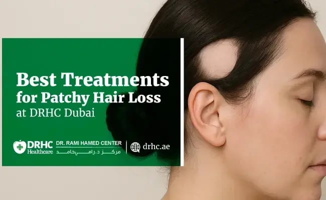 Best Treatments for Patchy Hair Loss at DRHC Dubai