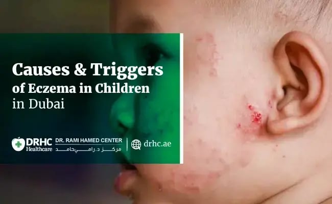 Causes & Triggers of Eczema in Children in Dubai