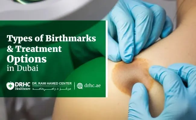 Types of Birthmarks & Treatment Options in Dubai