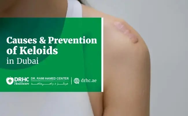 Causes & Prevention of Keloids in Dubai