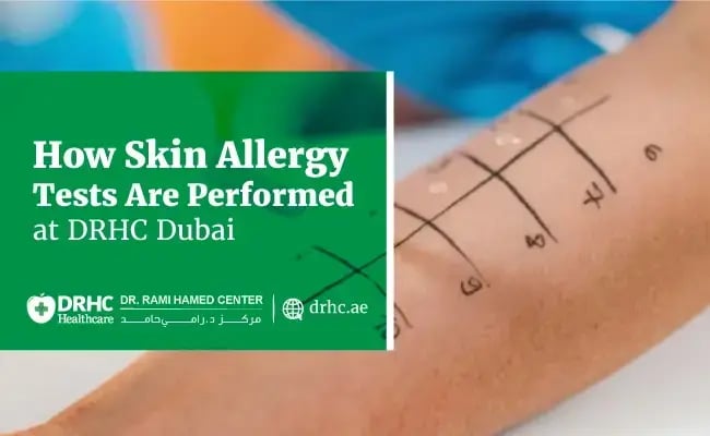 How Skin Allergy Tests Are Performed at DRHC Dubai