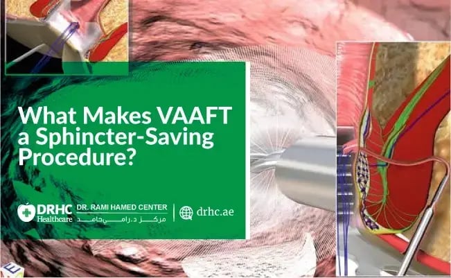 What Makes VAAFT a Sphincter-Saving Procedure?
