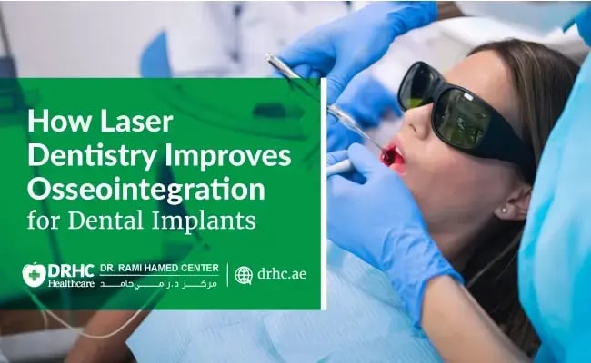 How Laser Dentistry Improves Osseointegration for Dental Implants