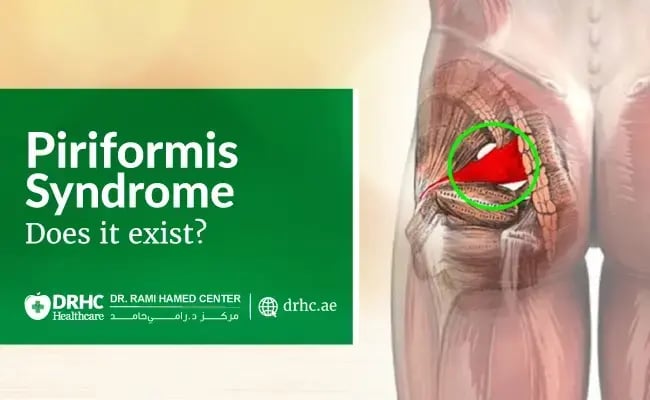 Piriformis Syndrome – Does it exist?