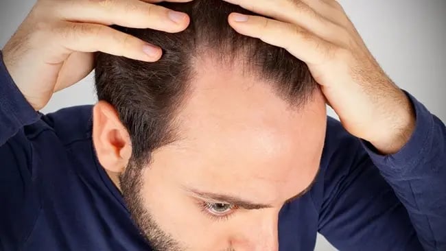 Early Hair Thinning? 7 Signs You Should Start Treatment Before It’s Too Late