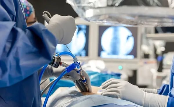 Endoscopic Spine Surgery