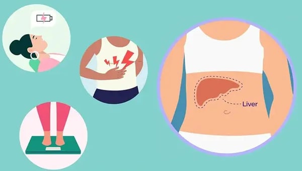 Fatty Liver Without Symptoms: Why It Is Often Found by Accident
