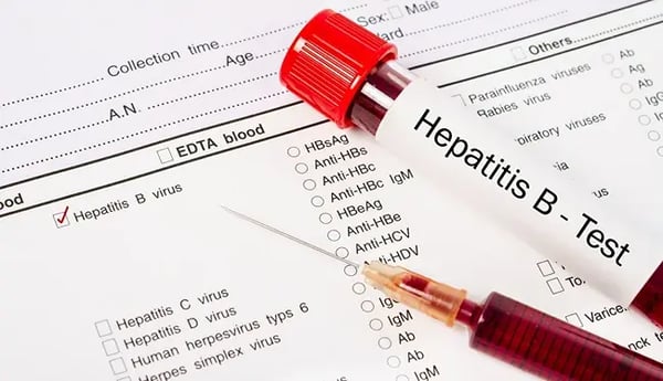 Hepatitis B Found on a Blood Test: What Should You Do Next?