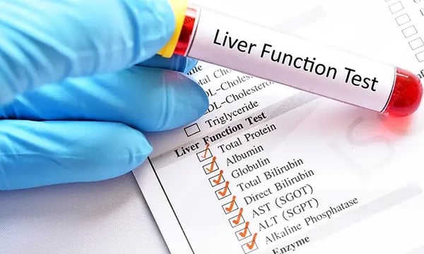 High ALT, AST or GGT: When Should You See a Gastroenterologist?