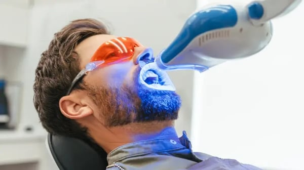 Laser-Teeth-whitening-post-drhc-dubai