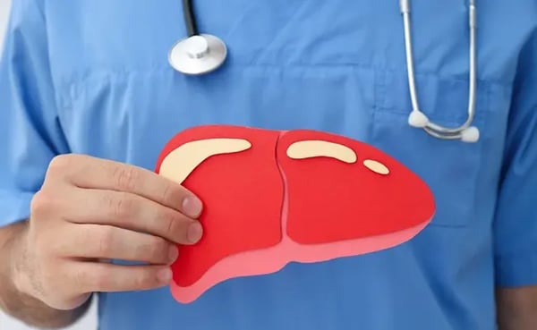 Normal ALT and AST but Fatty Liver? What Your Results Mean