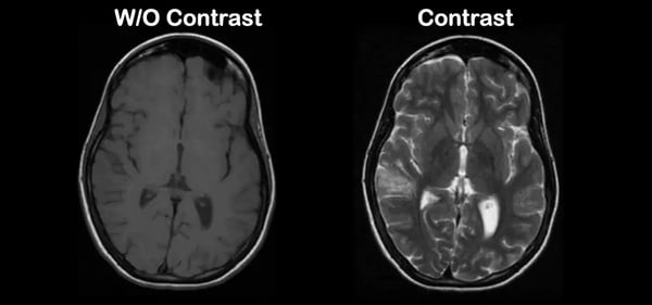 Sample-of-contrast-with-and-without