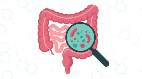 What Can a Colonoscopy Detect?
