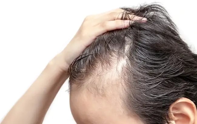 Why Your Hair Is Thinning (Even If You’re Healthy) – Hidden Causes Explained