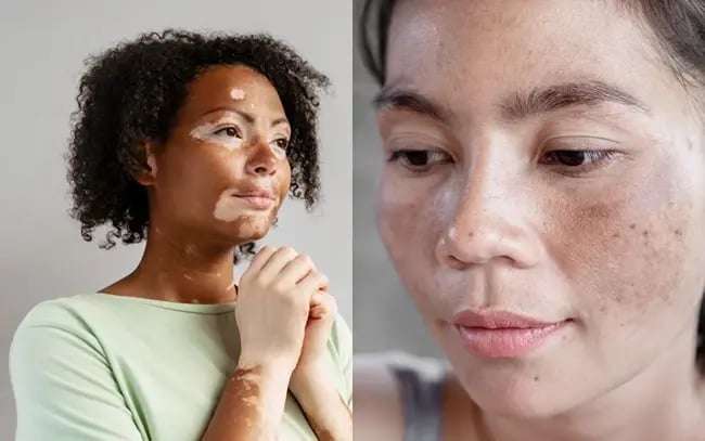 Your Skin Journey in Dubai: How DRHC Healthcare Connects Primary Care in Majan to Advanced Dermatology