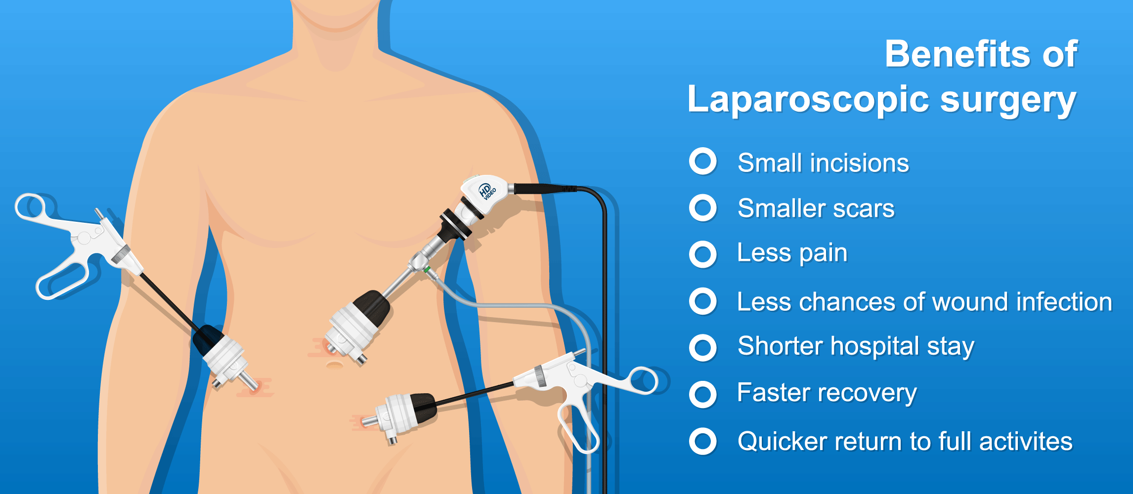 benefits-of-laparoscopic-surgery-[Converted]