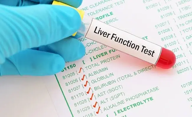 ALT, AST and GGT: Understanding Your Liver Blood Tests