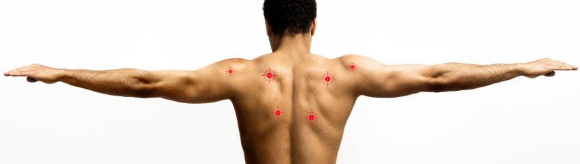 Trigger points