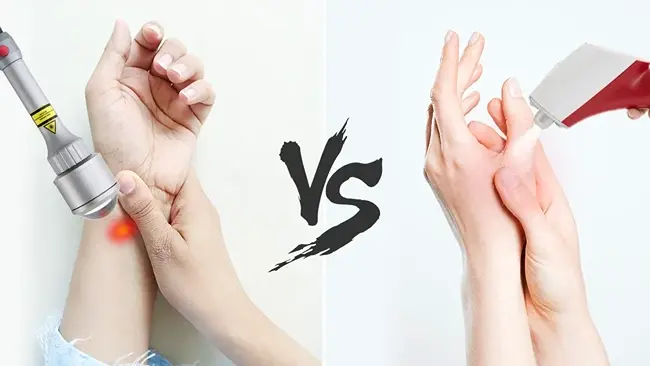Cryotherapy vs Laser for Skin Lesions: Which Treatment Is Better?