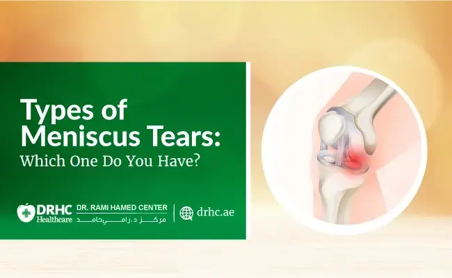 Types of Meniscus Tears: Which One Do You Have?