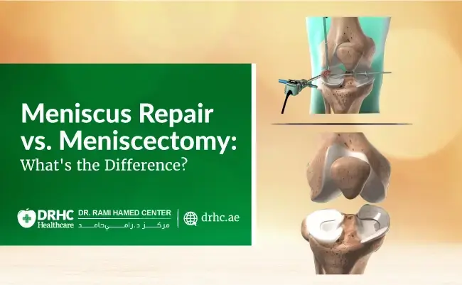 Meniscus Repair vs. Meniscectomy: What's the Difference?
