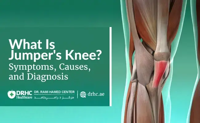 What Is Jumper's Knee? Symptoms, Causes, and Diagnosis