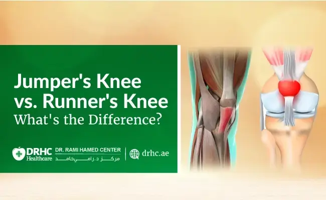 Jumper's Knee vs. Runner's Knee-What's the Difference?