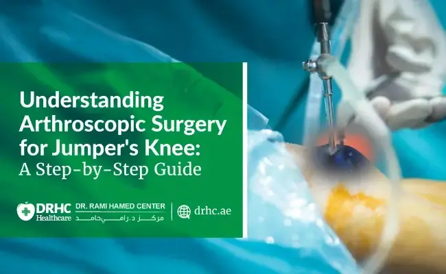 Understanding Arthroscopic Surgery for Jumper's Knee: A Step-by-Step Guide