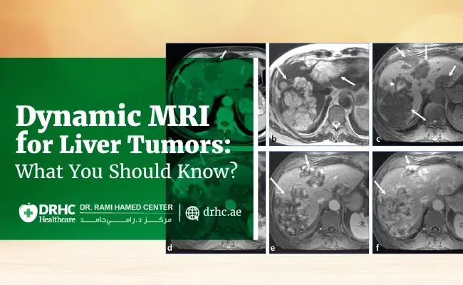 Dynamic MRI for Liver Tumors: What You Should Know